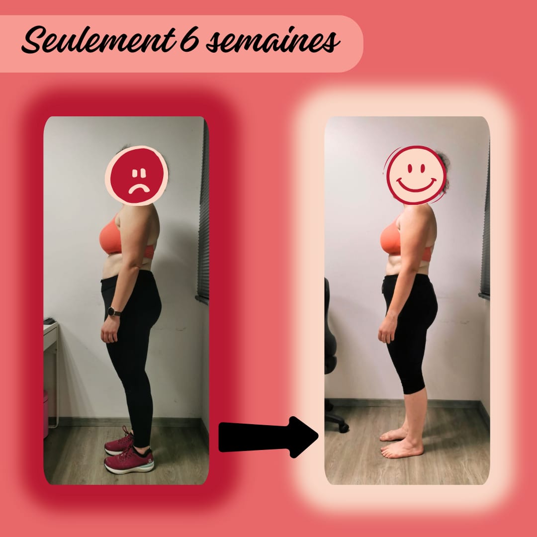 Silhouette avant après avec un ventre, des bras et des fesses raffermies